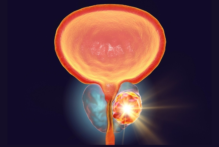 Prostate & BPH Care